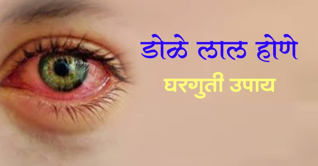 डोळे लाल होणे घरगुती उपाय/डोळे लाल झाल्यावर घरगुती उपाय (dole lal hone upay in marathi)
