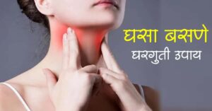 Read more about the article घसा बसणे घरगुती उपाय – Top 10 Home Remedies For Sore Throat