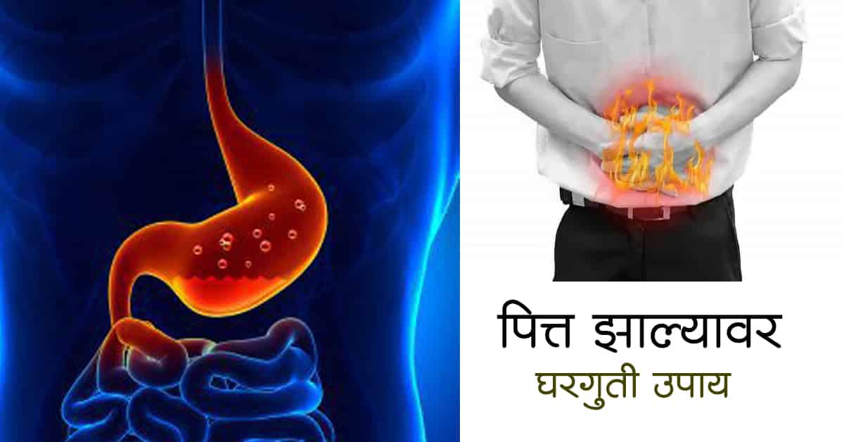 Read more about the article पित्त झाल्यावर घरगुती उपाय – Best 10 Home Remedies