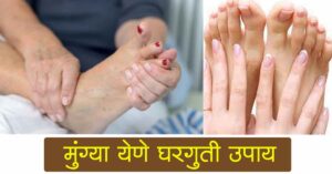 Read more about the article मुंग्या येणे / हाताला पायाला मुंग्या येणे उपचार – Best 9 Home Remedies