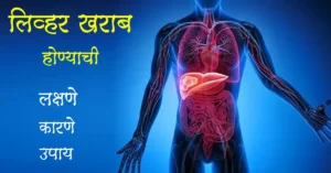 Read more about the article लिव्हर खराब होण्याची लक्षणे | कारणे – Best 7 remedies